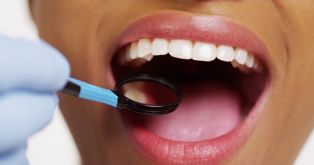 Natural ways to keep your teeth white